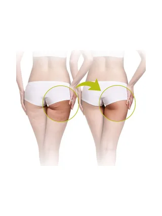 LANAFORM CELL ROLLER 3